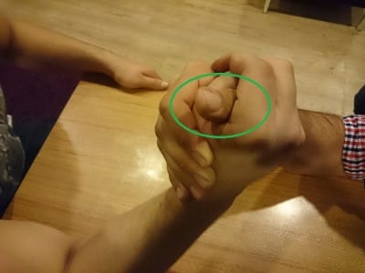 Rakibinizin-baş-parmağını-yüksekten-kavrayın-UzmanTedavi.NET